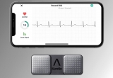 Oc AliveCor ķɑЫ@߶헌oЧ